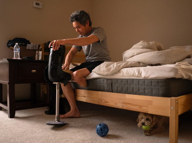 Jeffrey Wu, 47, of Lakeville, Minnesota, prepares to put on a prosthetic brace to help get around his house after waking up from a brief nap at his home on Tuesday, December 5, 2023, before reporting to his late-night shift job at a dairy plant. Wu had part of his leg amputated after his Jeep rolled back on him at a gas station, crushing his leg. Wu said he thought he put his 2014 Jeep Grand Cherokee - which had an unrepaired safety recall for its problematic gear shifter - into park, but instead, it rolled backward and struck him on March 4, 2022.