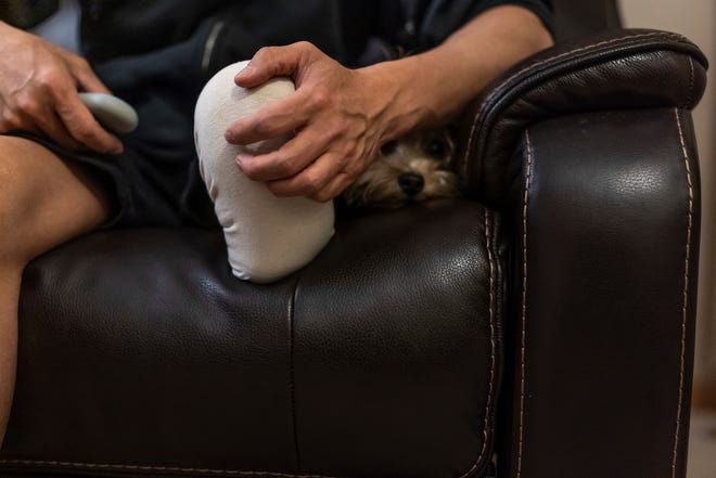 Jeff Wu, 47, of Lakeville, Minnesota sits in a chair with his dog Willy in the living room of his home on Tuesday, December 5, 2023, while talking about the accident that caused him to have his leg amputated.