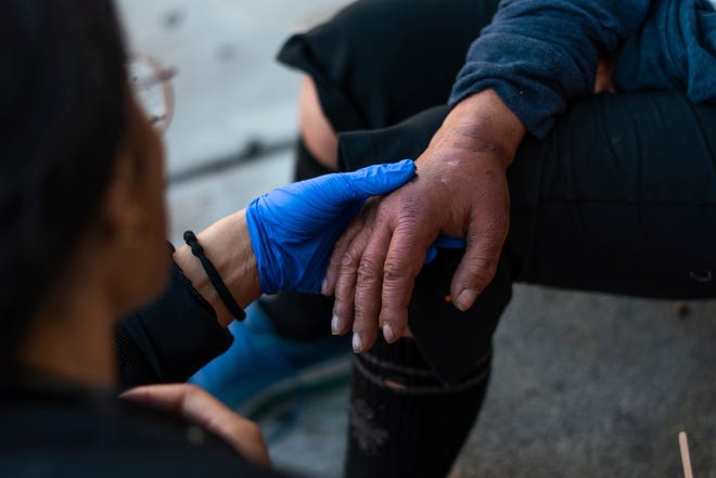 Community Health and Social Services family medicine physician Dr. Shaina Shetty, left, of the Community Health and Social Services looks over the hand of Debbie Cieslak, 50, of Detroit, as she checks on her needs while dealing with homelessness during a street medicine outreach outside of Pope Francis Center in Detroit on Monday, August 12, 2024. CHASS recently received $562,868 in American Plan Act dollars to expand its street medicine team, to aid people experiencing homelessness on the streets taking medical care right to the people who need it.